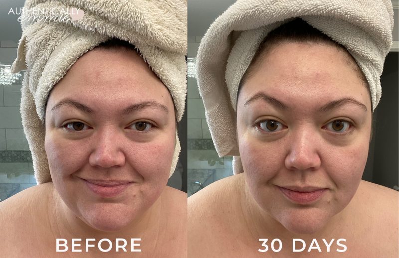 SkinCeuticals and Biossance skincare results after 30 days